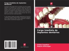 Carga imediata de implantes dentários - Tapadiya, Vishal;Kshirsagar, Rajesh