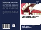 Nemedlennaq ustanowka zubnyh implantatow