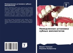 Nemedlennaq ustanowka zubnyh implantatow - Tapadiq, Vishal;Kshirsagar, Radzhesh