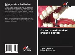 Carico immediato degli impianti dentali - Tapadiya, Vishal;Kshirsagar, Rajesh