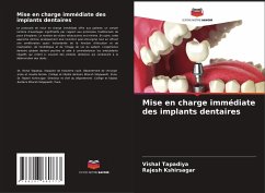 Mise en charge immédiate des implants dentaires - Tapadiya, Vishal;Kshirsagar, Rajesh