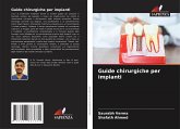 Guide chirurgiche per impianti