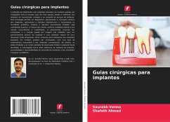 Guias cirúrgicas para implantes - Verma, Saurabh;Ahmed, Shafath