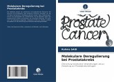 Molekulare Deregulierung bei Prostatakrebs