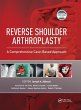 Reverse Shoulder Arthroplasty - Bild 1