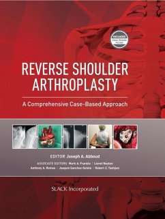 Reverse Shoulder Arthroplasty - Abboud, Joseph