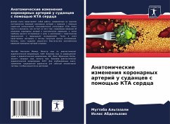 Anatomicheskie izmeneniq koronarnyh arterij u sudancew s pomosch'ü KTA serdca - Al'gazali, Mugtaba;Abdel'aziz, Ihlas