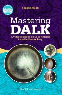 Mastering DALK - Jacob, Soosan