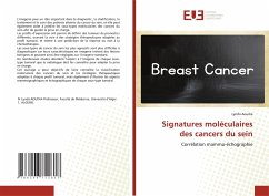 Signatures moléculaires des cancers du sein - Aoudia, Lynda