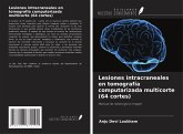 Lesiones intracraneales en tomografía computarizada multicorte (64 cortes)