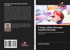 Il laser nella chirurgia maxillo-facciale - Alalawi, Ammar