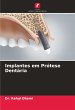 Implantes em Prótese Dentária - Bild 1