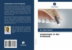 Implantate in der Prothetik - Dhami, Dr. Rahul