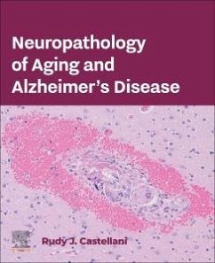Cover Neuropathology of Aging and Alzheimer's Disease