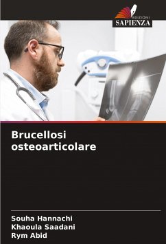 Brucellosi osteoarticolare - Hannachi, Souha;Saadani, Khaoula;Abid, Rym