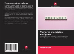 Tumores mamários malignos - Aoudia, Lynda