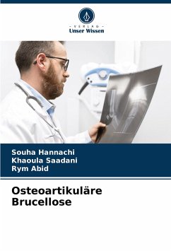 Osteoartikuläre Brucellose - Hannachi, Souha;Saadani, Khaoula;Abid, Rym