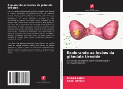 Explorando as lesões da glândula tireoide - Zaher, Ahmed;Ahmad, Aqeel