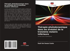 Thérapie photodynamique dans les alvéoles de la troisième molaire inférieure - Costa, Sueli de Souza