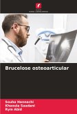 Brucelose osteoarticular