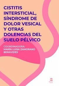 Cistitis Intersticial, Sindrome De Dolor Vesical