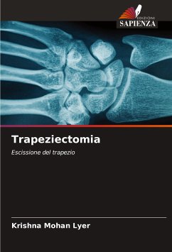 Trapeziectomia - Lyer, Krishna Mohan