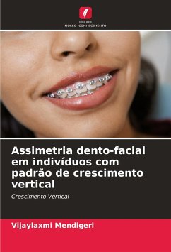 Assimetria dento-facial em indivíduos com padrão de crescimento vertical - Mendigeri, Vijaylaxmi