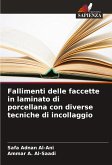 Fallimenti delle faccette in laminato di porcellana con diverse tecniche di incollaggio