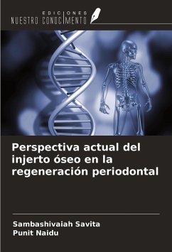 Perspectiva actual del injerto óseo en la regeneración periodontal - Savita, Sambashivaiah; Naidu, Punit