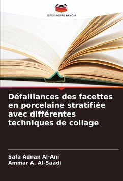 Défaillances des facettes en porcelaine stratifiée avec différentes techniques de collage - Al-Ani, Safa Adnan;Al-Saadi, Ammar A.