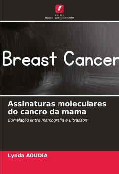 Assinaturas moleculares do cancro da mama - Aoudia, Lynda