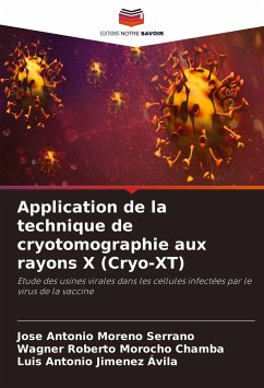 Application de la technique de cryotomographie aux rayons X (Cryo-XT) - Moreno Serrano, Jose Antonio;Morocho Chamba, Wagner Roberto;Jimenez Ávila, Luis Antonio