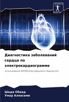 Diagnostika zabolewanij serdca po älektrokardiogramme - Obaid, Shadi;Alqasemi, Umar
