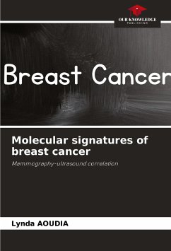 Molecular signatures of breast cancer - Aoudia, Lynda