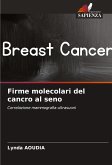 Firme molecolari del cancro al seno