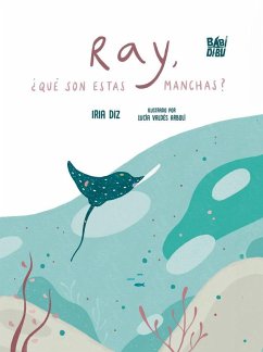 Ray, ¿qué son estas manchas?