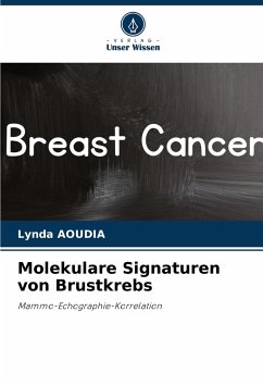 Molekulare Signaturen von Brustkrebs - Aoudia, Lynda