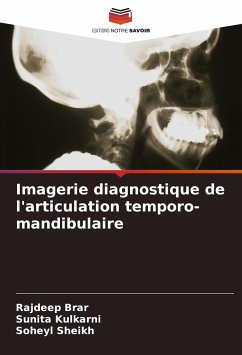 Imagerie diagnostique de l'articulation temporo-mandibulaire - Brar, Rajdeep;Kulkarni, Sunita;Sheikh, Soheyl