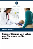 Segmentierung von Leber und Tumoren in CT-Bildern