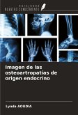 Imagen de las osteoartropatías de origen endocrino