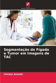 Segmentação de Fígado e Tumor em Imagens de TAC