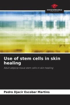 Use of stem cells in skin healing - Escobar Martins, Pedro Djacir