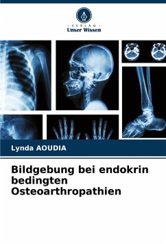 Bildgebung bei endokrin bedingten Osteoarthropathien - Aoudia, Lynda