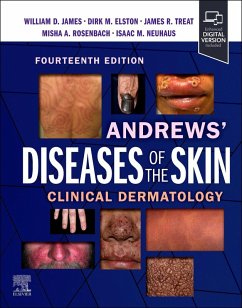 Andrews' Diseases of the Skin - James, William D; Elston, Dirk M; Treat, James R; Rosenbach, Misha A