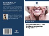 Hygienische Pflege von implantatgetragenen Vollprothesen