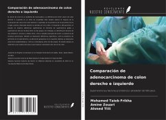 Comparación de adenocarcinoma de colon derecho e izquierdo - Frikha, Mohamed Taieb; Zouari, Amine; Tlili, Ahmed