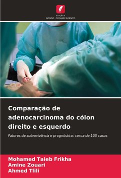 Comparação de adenocarcinoma do cólon direito e esquerdo - Frikha, Mohamed Taieb;Zouari, Amine;Tlili, Ahmed