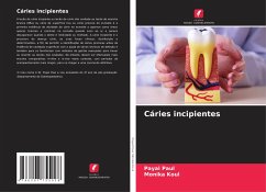 Cáries incipientes - Paul, Payal;Koul, Monika