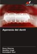 Agenesia dei denti - Bild 1