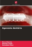 Agenesia dentária